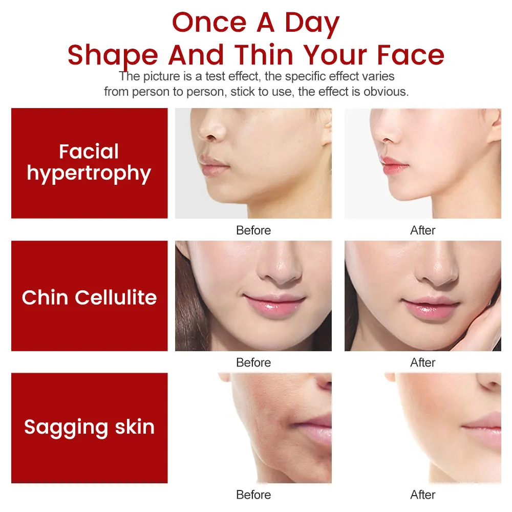 

Face Lifting Machine Electric V-Face Shaping Massager Vibration Slimming Double Chin Reducer V-Line Cheek Lift Up Face Slimming