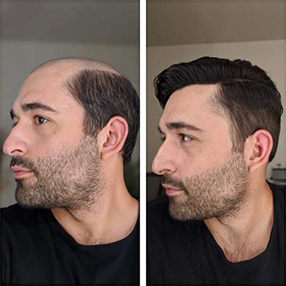 

Toupee Men Natural Hair Wig for Men Toupee Men's Wig Male Wigs for Man Hairpiece Mens Hair Replacement System