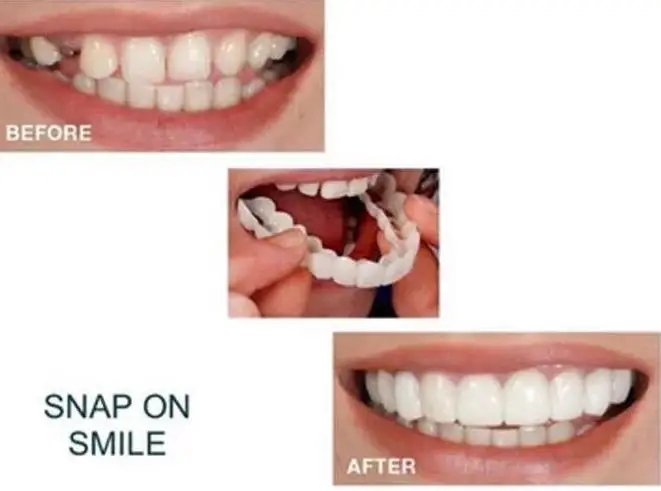 

Silicone artificial tooth dentures
