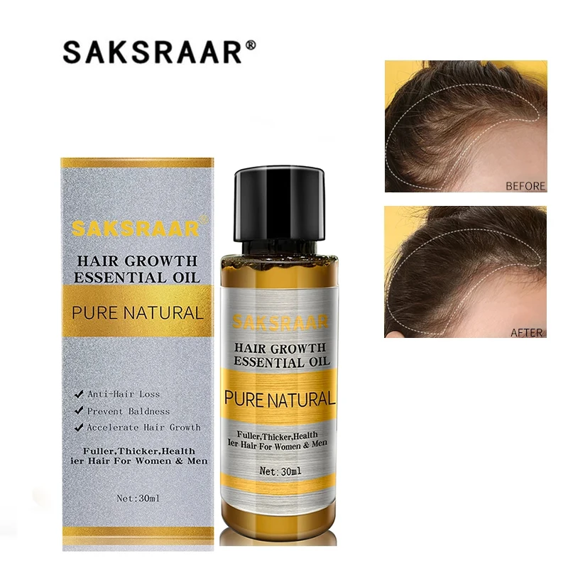 

Уход За Волосами Эфирные масла для роста волос эссенция оригинальная Подлинная 100% жидкость для выпадения волос здоровое средство красоты