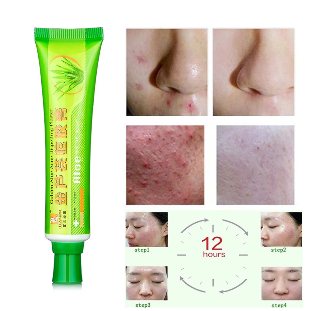 30 г уход за кожей лица крем от акне контроль маслом продукты для красота