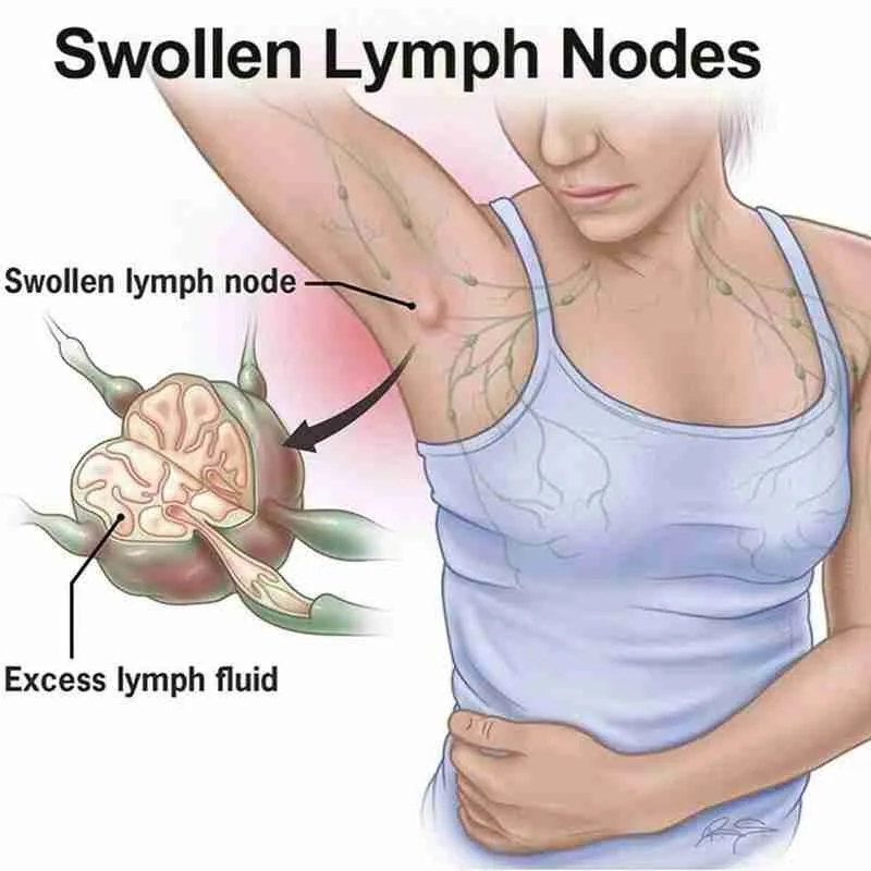 

10pcs Lymphatic Detox Patch Neck Anti-Swelling Herbs Sticker Lymphatic Health Patch Medical Plaster Body Relaxation Health Care