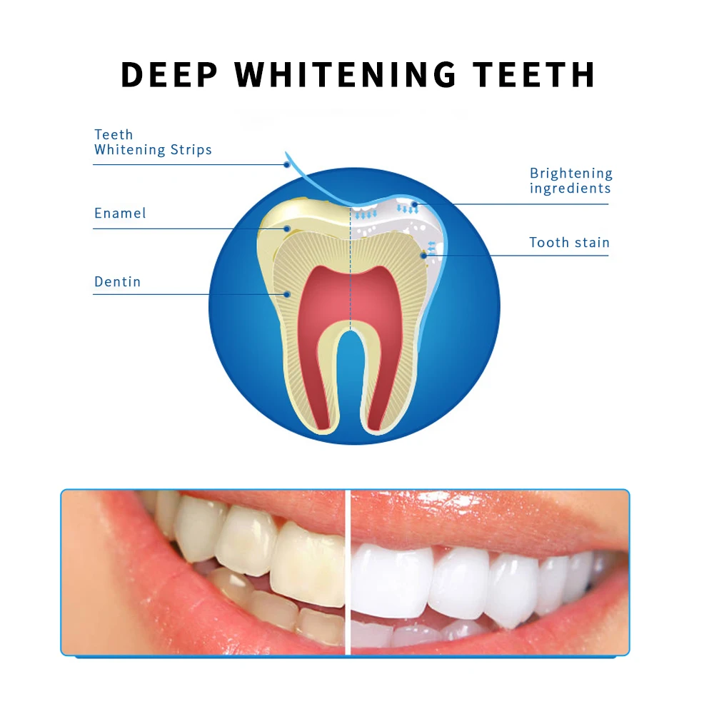 Полоски для отбеливания зубов полоски удаления пятен белая полоска геля гигиены