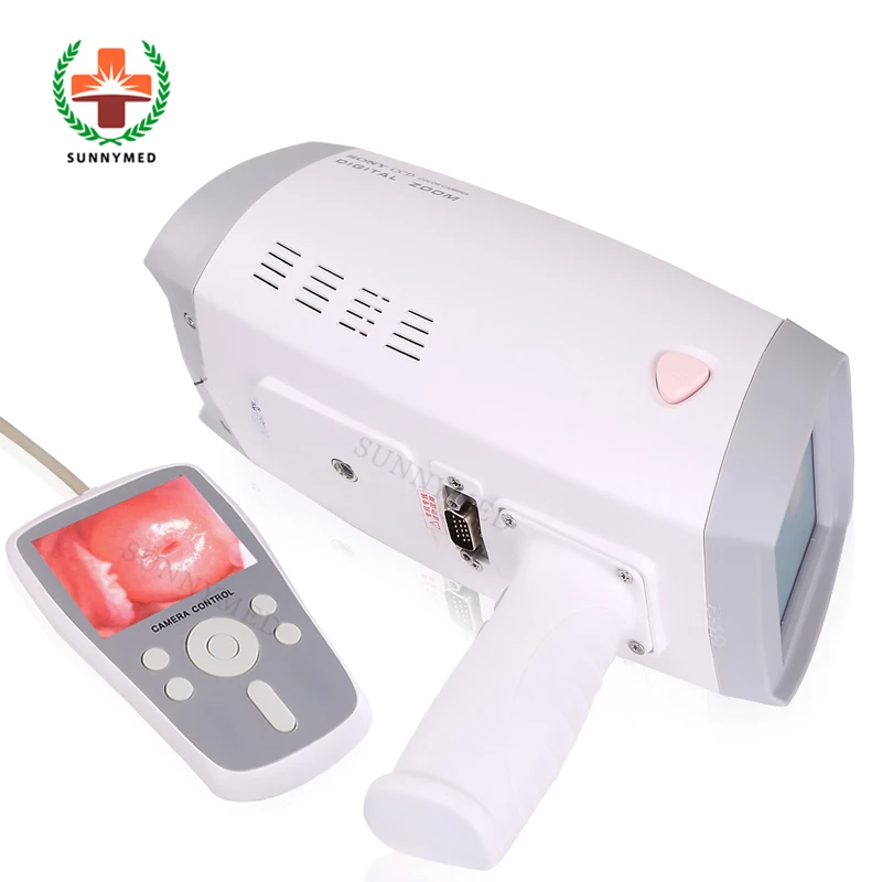 

Электронный портативный кольпоскоп для больницы