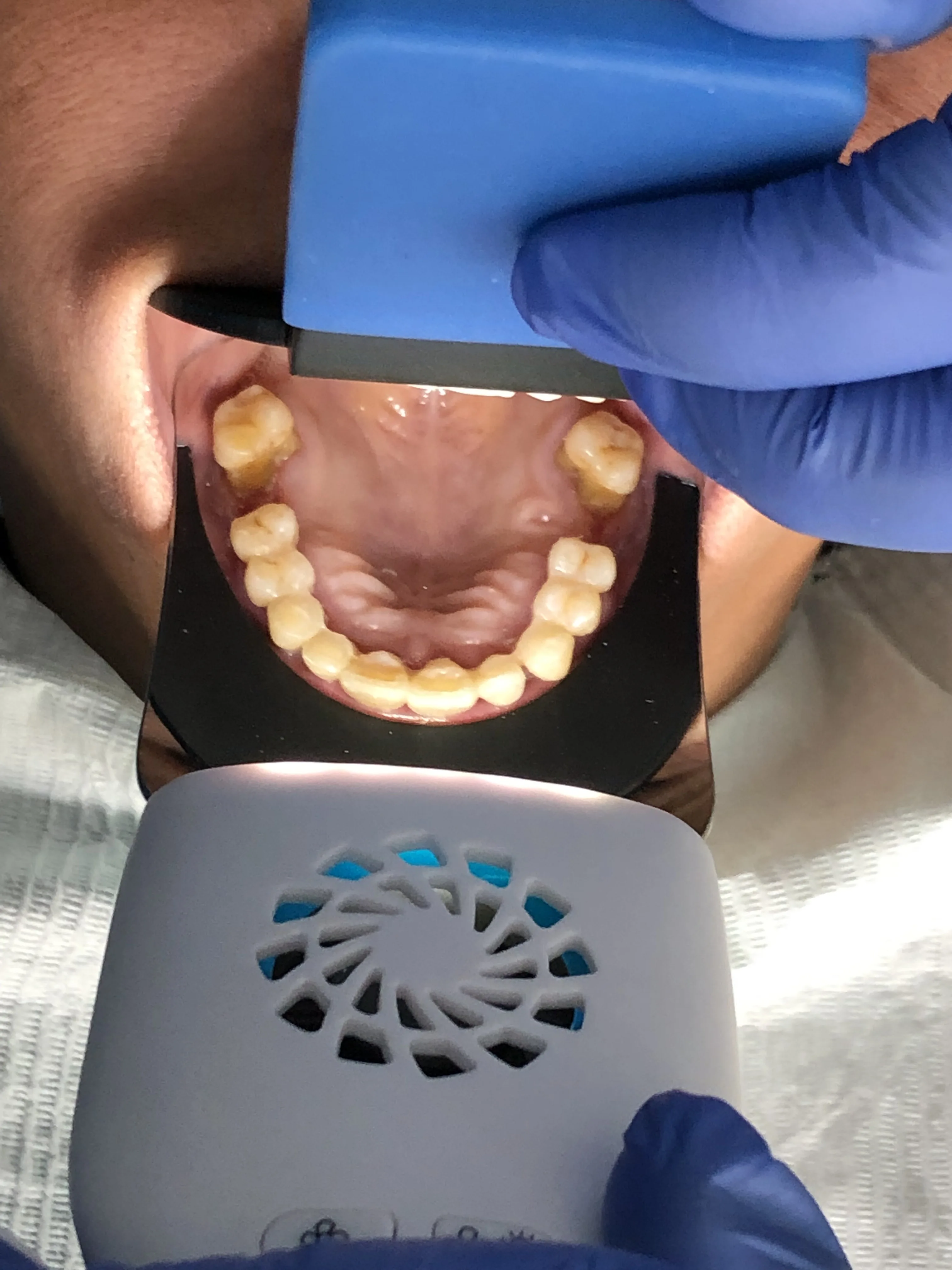 Ортодонтический ротовой полости стоматологический зеркальный отражатель для