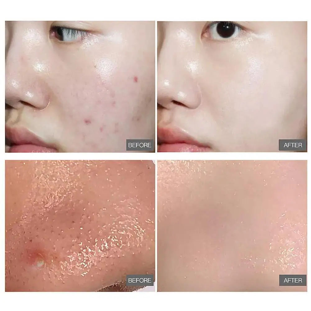 

Beauty Tools Cleanser Cristlia Vacuum Cleansing Gel Oil Gel Cleansing Moisturizing Hotsale Powder Dirt Face Light And E2F5
