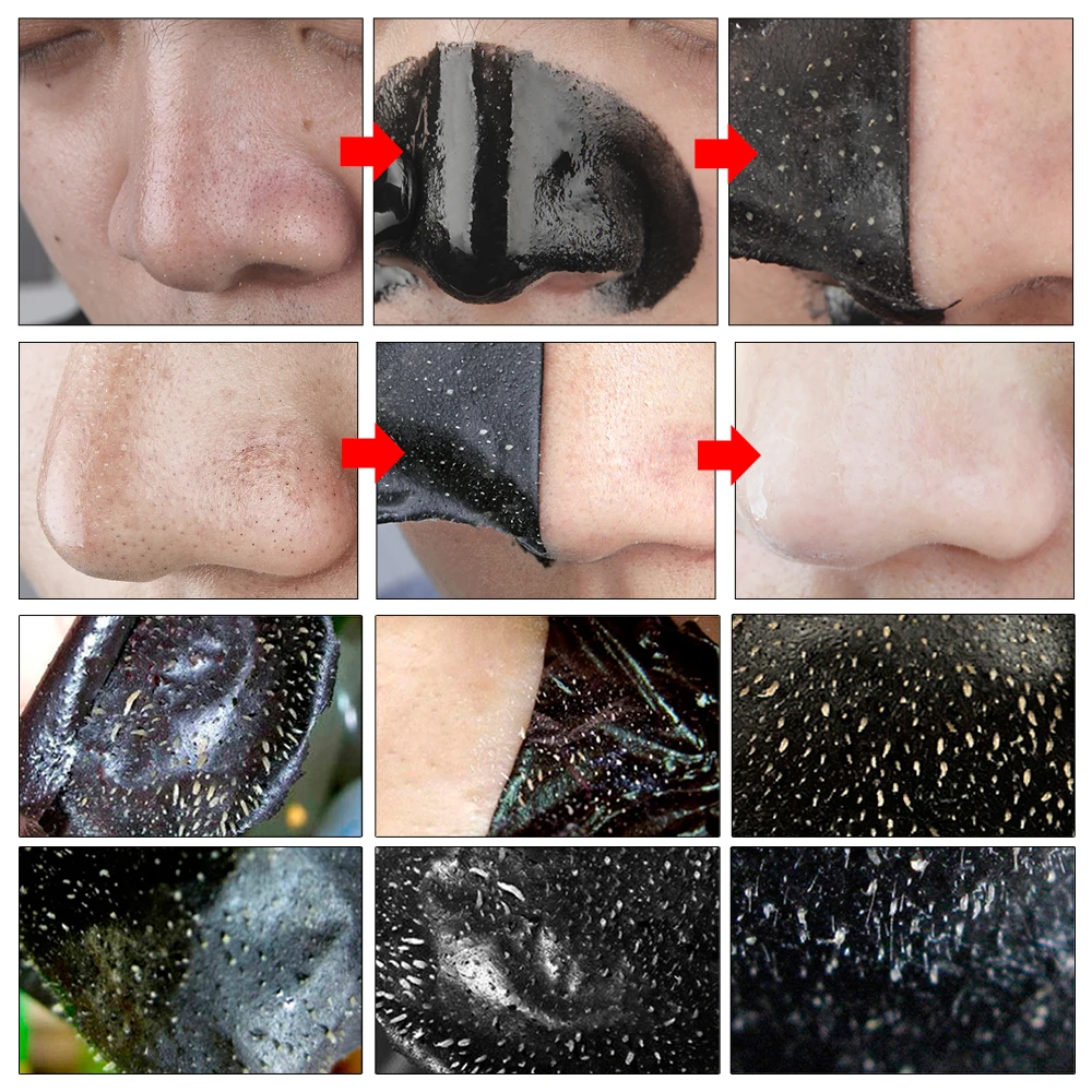 

LANBENA 10pcs Blackhead Remover Chin Nose Mask Painless Black Mask Charcoal Peel Off Mask Face Acne Treatment Control Skin Care