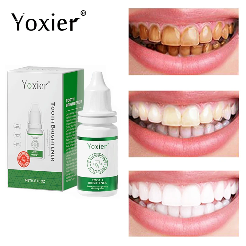 

Эссенция для отбеливания зубов, свежее дыхание, удаляет зубной налет, сыворотка для отбеливания зубов, улыбка, стоматология, товары для гиги...