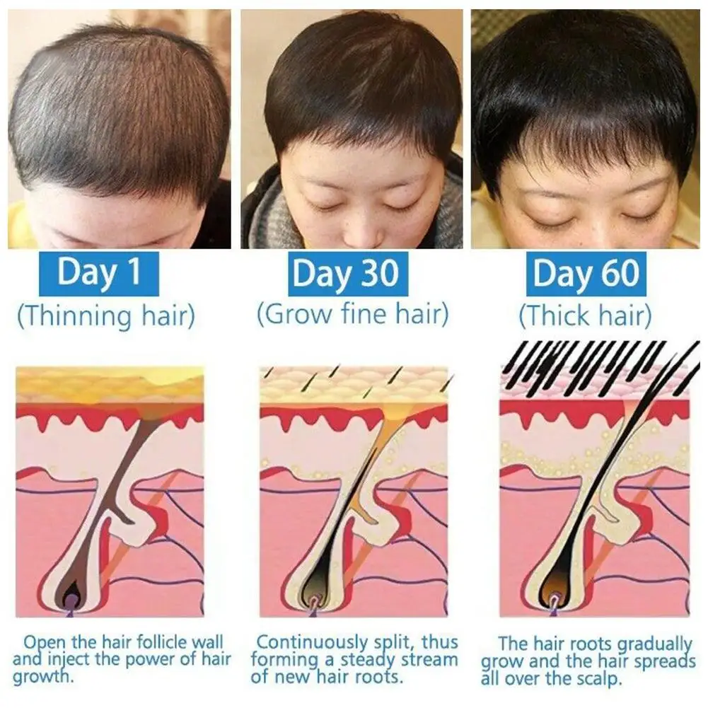 

1Pcs 20ml Tea Tree Nourishing Hair Growth Essence Treatment Loss Hair Hair Care Make Anti-Lose Oil Hair Smoother Oil Preven C3T4