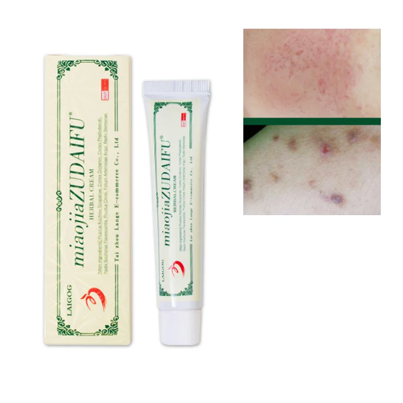 

Anti-itch Cream 15g Ointment Skin Cream Aloe Vera Gel 100% Acne Treatment Skin Skin Whitening Whitening Cream Face Cream