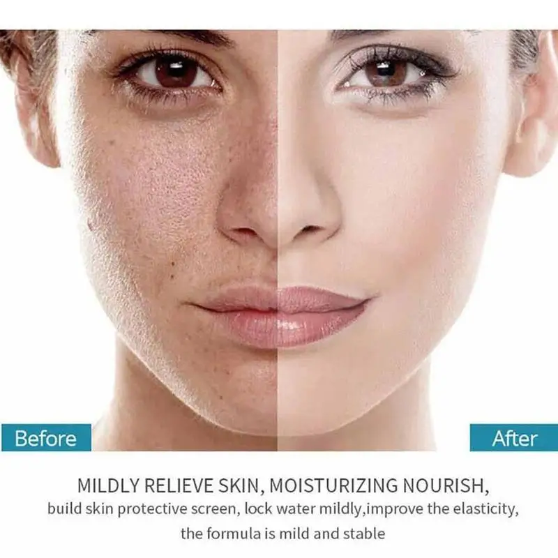 

2ml X 60 Pc Second Crack Yeast Hyaluronic Acid Essence Pore Silky Contractive Skin Yue Moisturizing Yan Care D4B7