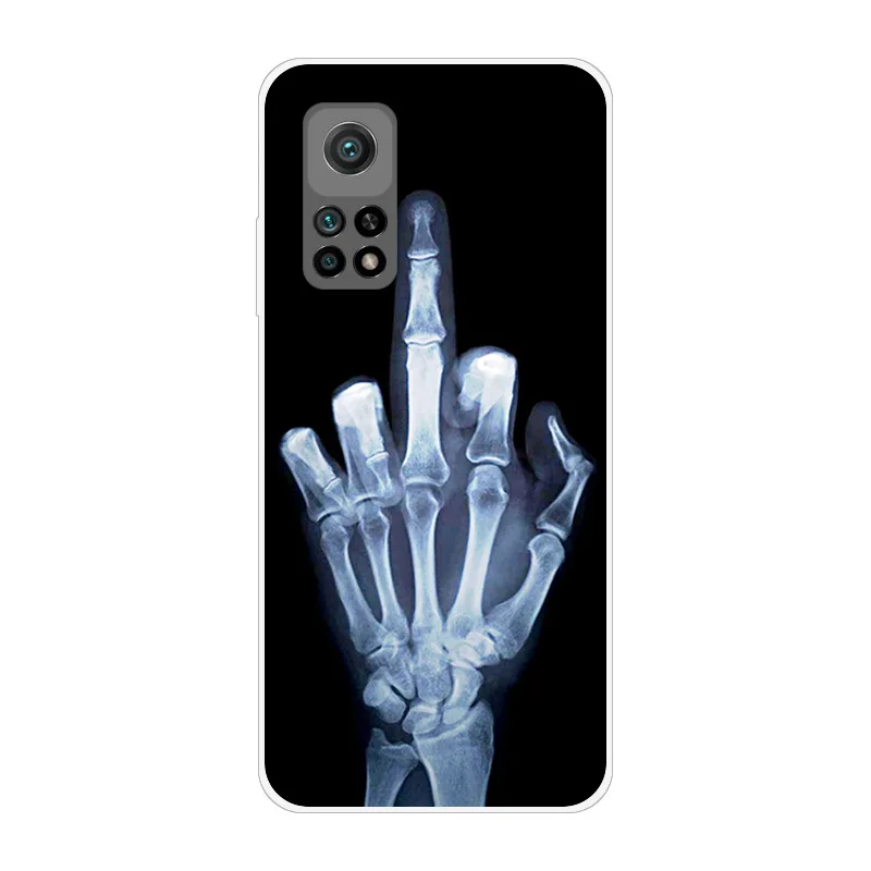 For Xiaomi Mi 10T 5G Case Shockproof Soft silicone TPU Back Cover For Xiaomi Mi10T Pro Phone Cases for Xiomi Mi 10 T 10T Coque