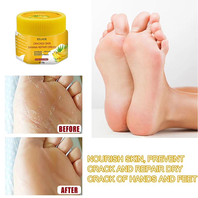 

Eelhoe Banana Foot Cream Anti-Drying Crack Heel Cracked Repair Smooth Removal Dead Skin Moisturizing Nourishing Hand Feet Care