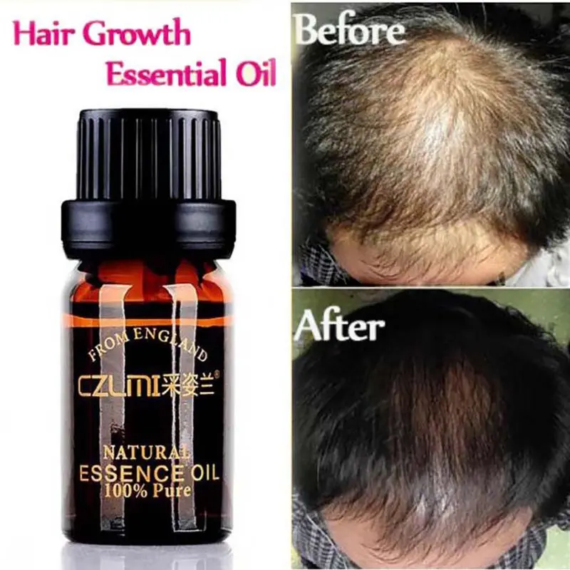 10 мл/бутылка уход за натуральными волосами без побочных эффектов выращивание