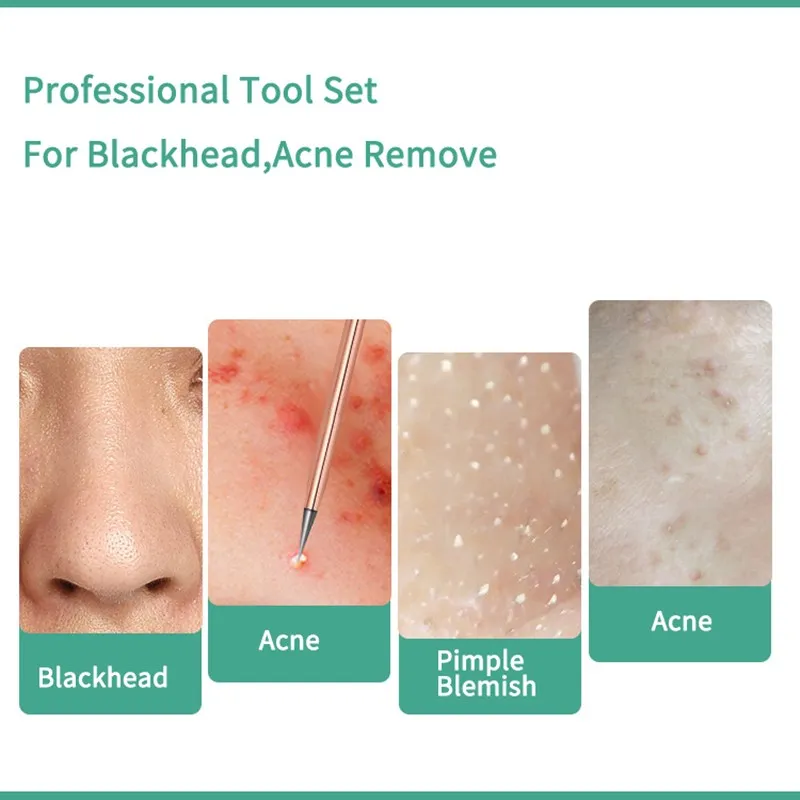 4 шт акне пятна для удаления угрей Extractor черных точек иглы очистки комплект с