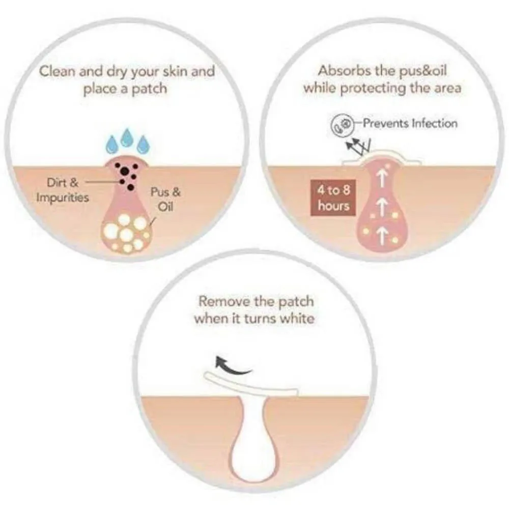 Skin Tag Remover Patch Ance Pimple Plaster Acne Cream Invisible Hydrocolloid Master Anti-infection Absorb Face Care |