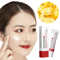 powerful whitening face cream freckle cream remove acne spots melanin skin lightening face cream brighten moisturizing skin care
