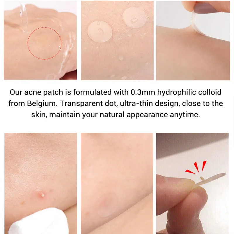 LANBENA Пластырь от прыщей и на чайном дереве невидимые наклейки лечение средство