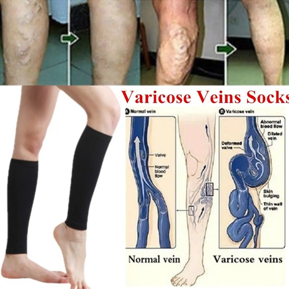 Компрессионные носки до щиколотки компрессионные для голени шины облегчения