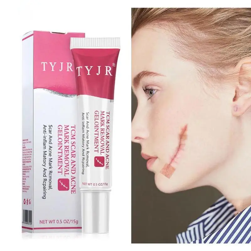 

Remove Pregnancy Scars Cream For Females Treatment Maternity Stretch Marks Scar Removal Moisturizing Cream