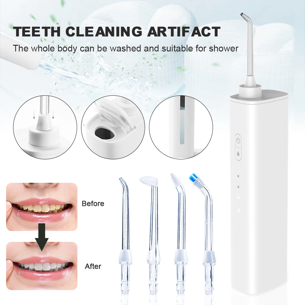 

Useful And Valuable Plaque Remover IPX7 Waterproof Water Flosser with 4 Nozzles 3 Modes Teeth Cleaning Device for Home Travel