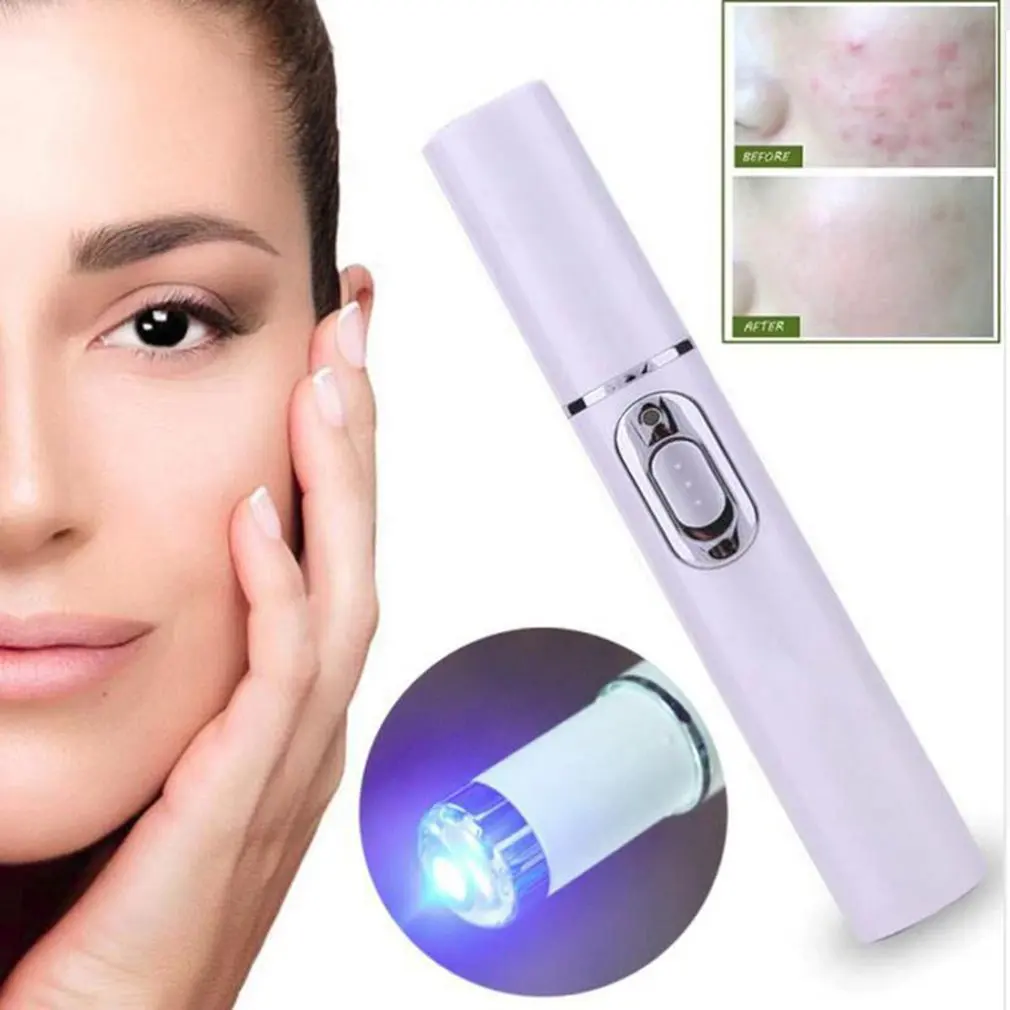 KD-7910 Acne Laser Pen Portable Wrinkle Removal Machine Durable Soft Scar Remover Device Blue Light Therapy Pen Massage Relax