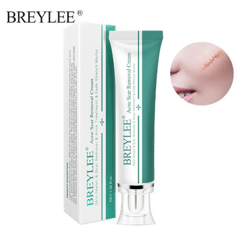 BREYLEE Scar Removal Cream Skin Care Face For Acne Stretch Remove Maternity Treatment Repair | Красота и здоровье