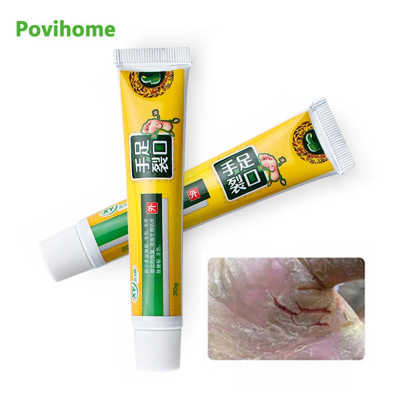 1 шт. 20 г восстанавливающий крем для кожи против трещин антигрибковый ног