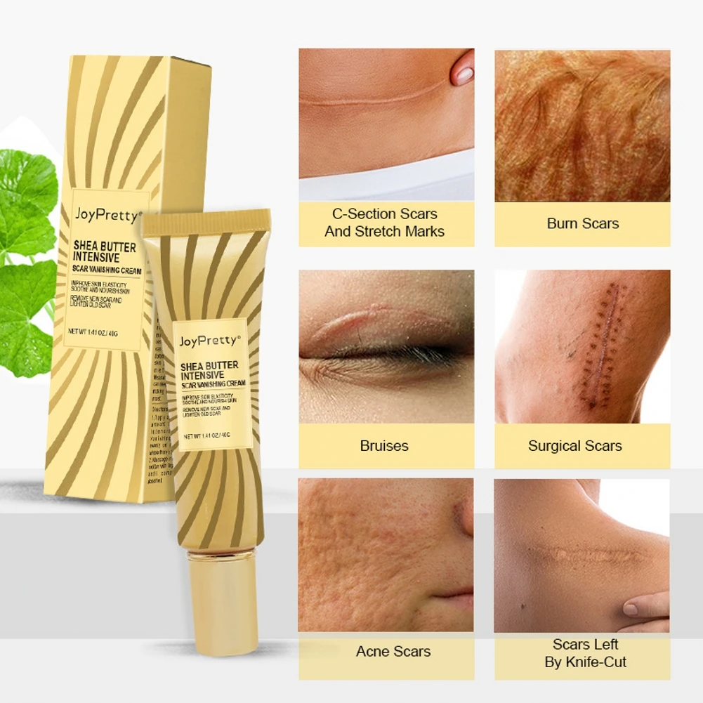 40g Acne Scar Removal Cream Pimples Stretch Marks Face Gel Remove Smoothing Whitening Moisturizing Body Skin Care | Красота и
