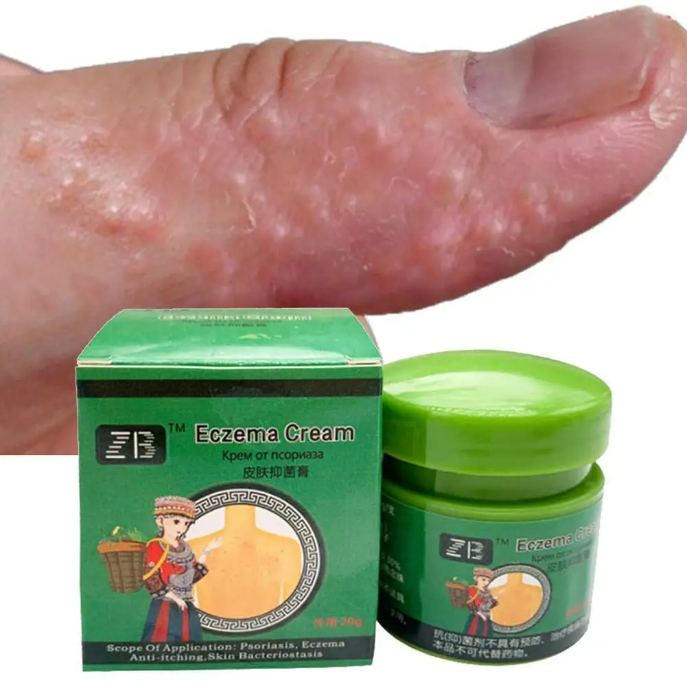 

Эффективный Антибактериальный крем для кожи от псориаза, дерматита, экземы, экземы