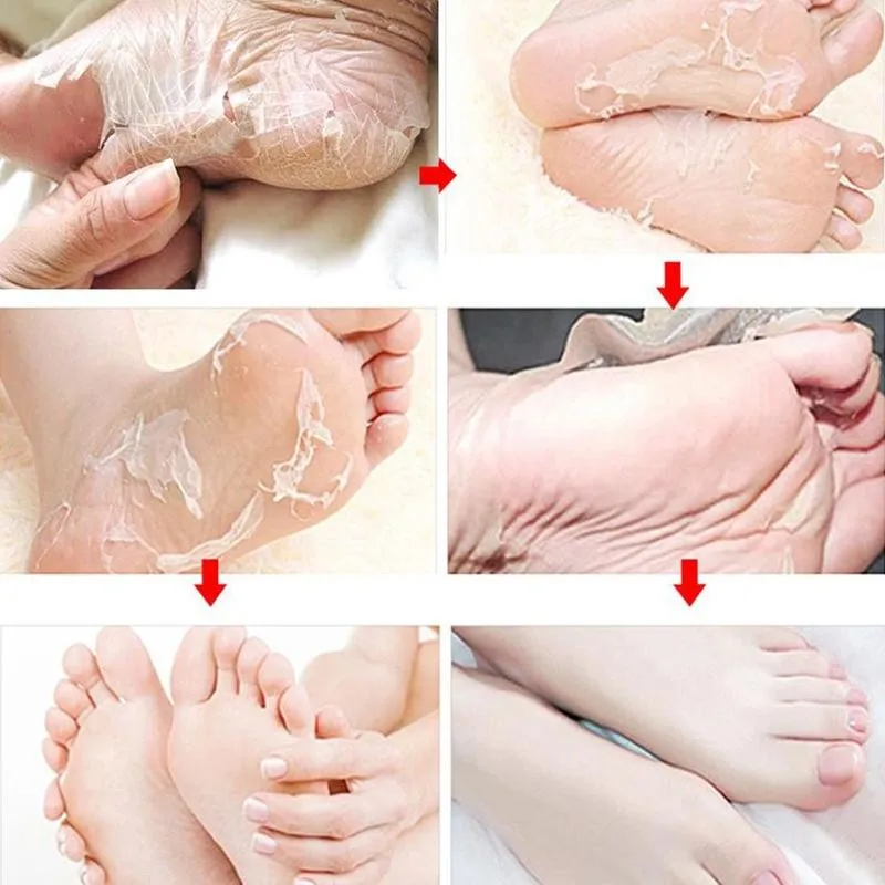 

2 Pairs 4pcs Dead Skin Remover Foot Mask Exfoliating Peeling Feet Baby Mask Foot Socks Mask Feet Mask Peeling For Pedicure R0F1