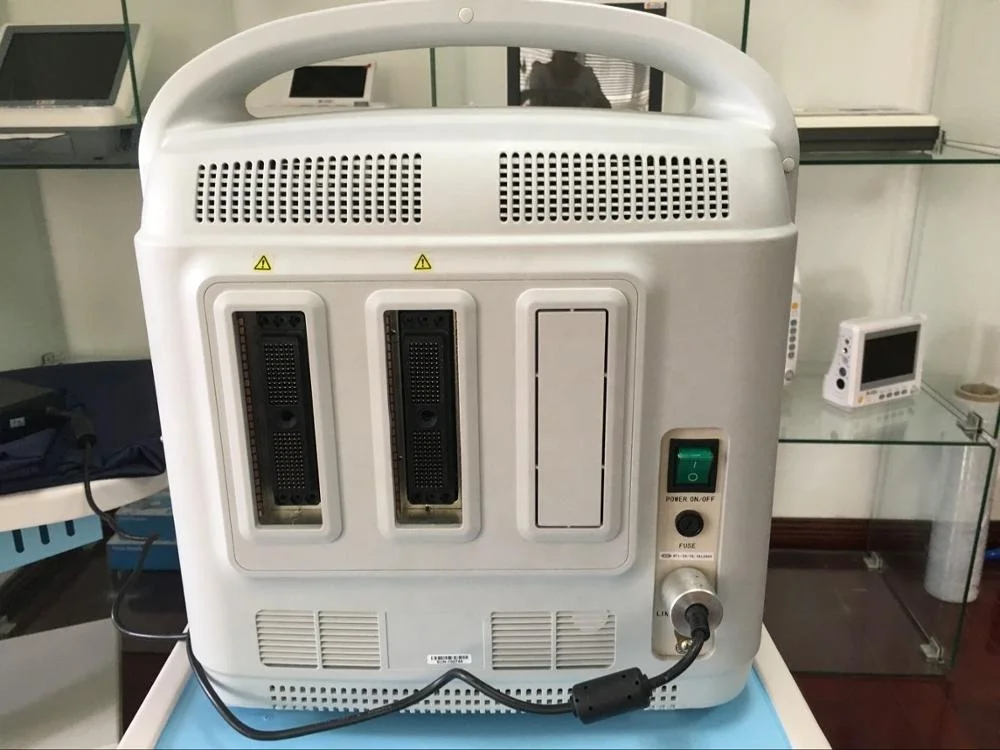 

High clear image color doppler medical scan Radiologist portable ultrasound 2D
