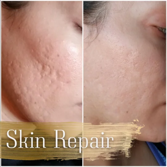 Экстракт змеиного яда сыворотка против морщин отбеливающая старения кожи лица 30