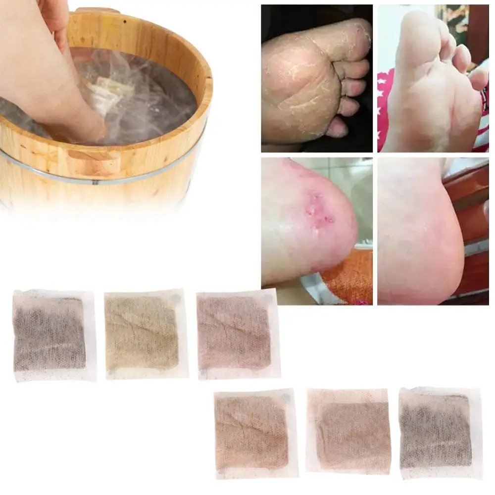 Natural Plants Foot Bath Powder Chinese Herbal Skin Health Care Callus Remover Soothing | Красота и здоровье