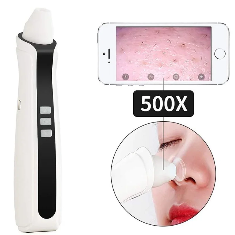 Визуальный Инструмент для удаления чёрных точек USB Перезаряжаемые поры лица