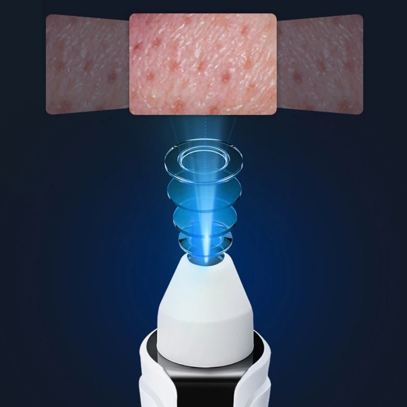 

Electric Pore Cleaner Smart Camera Visible Blackhead Remover Acne Comedones Vacuum Extractor Cleansing Instrument