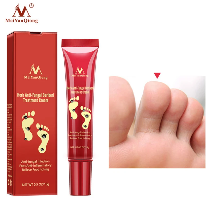 

Herbal Foot Cream Anti Fungal Infection Anti-inflammatory Fungus Feet Relieve Itching Gel Repair Dry Crack Feet Care Cream 15G