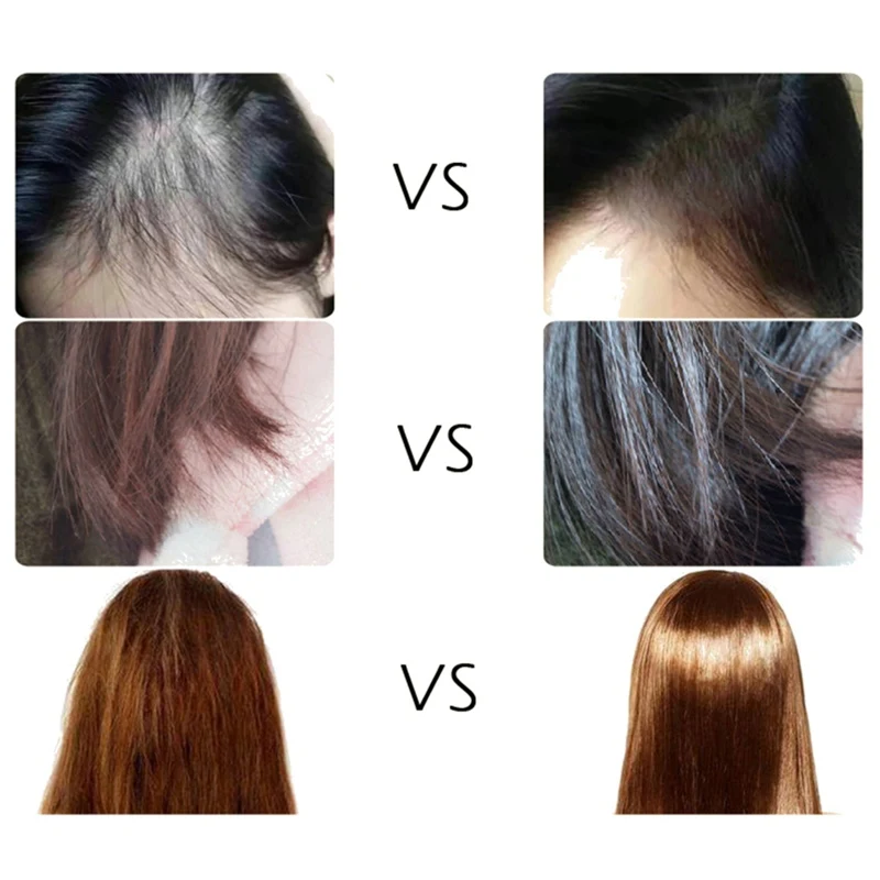 Бесплатное мытье марокканское масло для волос уход за волосами эфирное анти