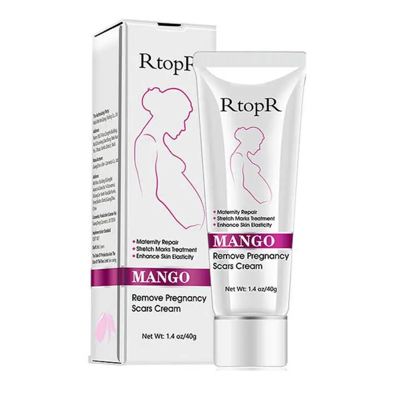 

Mild Mango Remove Pregnancy Scars Acne Cream Stretch Marks Treatment Maternity Repair Slack Line Abdomen Stretch Marks Cream