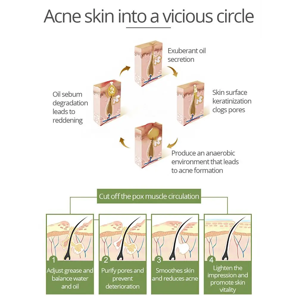 Яркий гламурный Тонер для чайного дерева термоусадочная вода удаления угрей