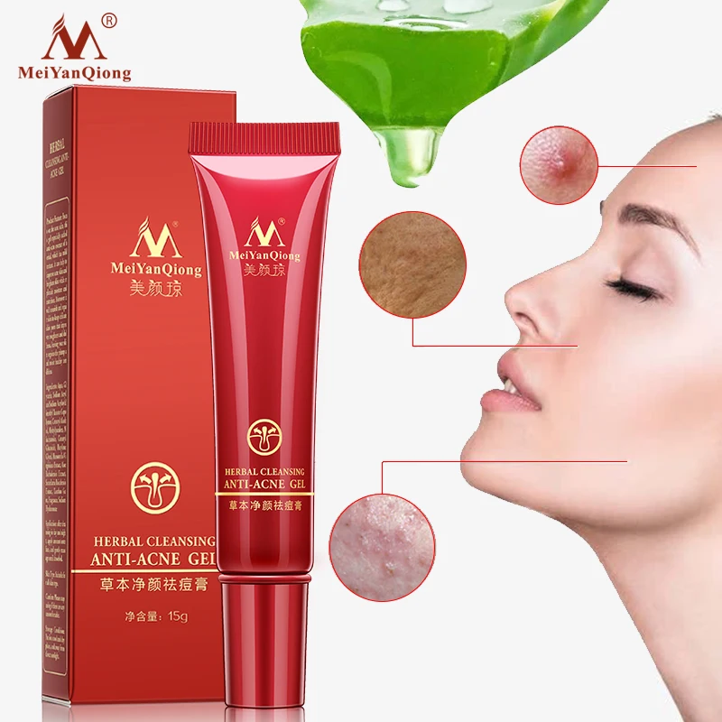 

Meiyanqiong High Quality Herbal Cleansing Face Anti Acne Treatment Cream Herbal Scar Removal Oily Skin Acne Spots Skin Care
