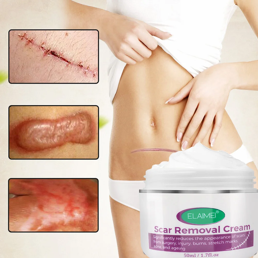 Scar Removal Cream For Acne Marks Burns Stretch Surgical Scars Promote New Skin Growth Treatment | Красота и здоровье