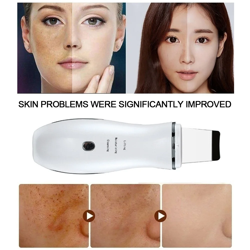 Вибрирующий очищающий скруббер для кожи вибрация удаление глубоких морщин лица