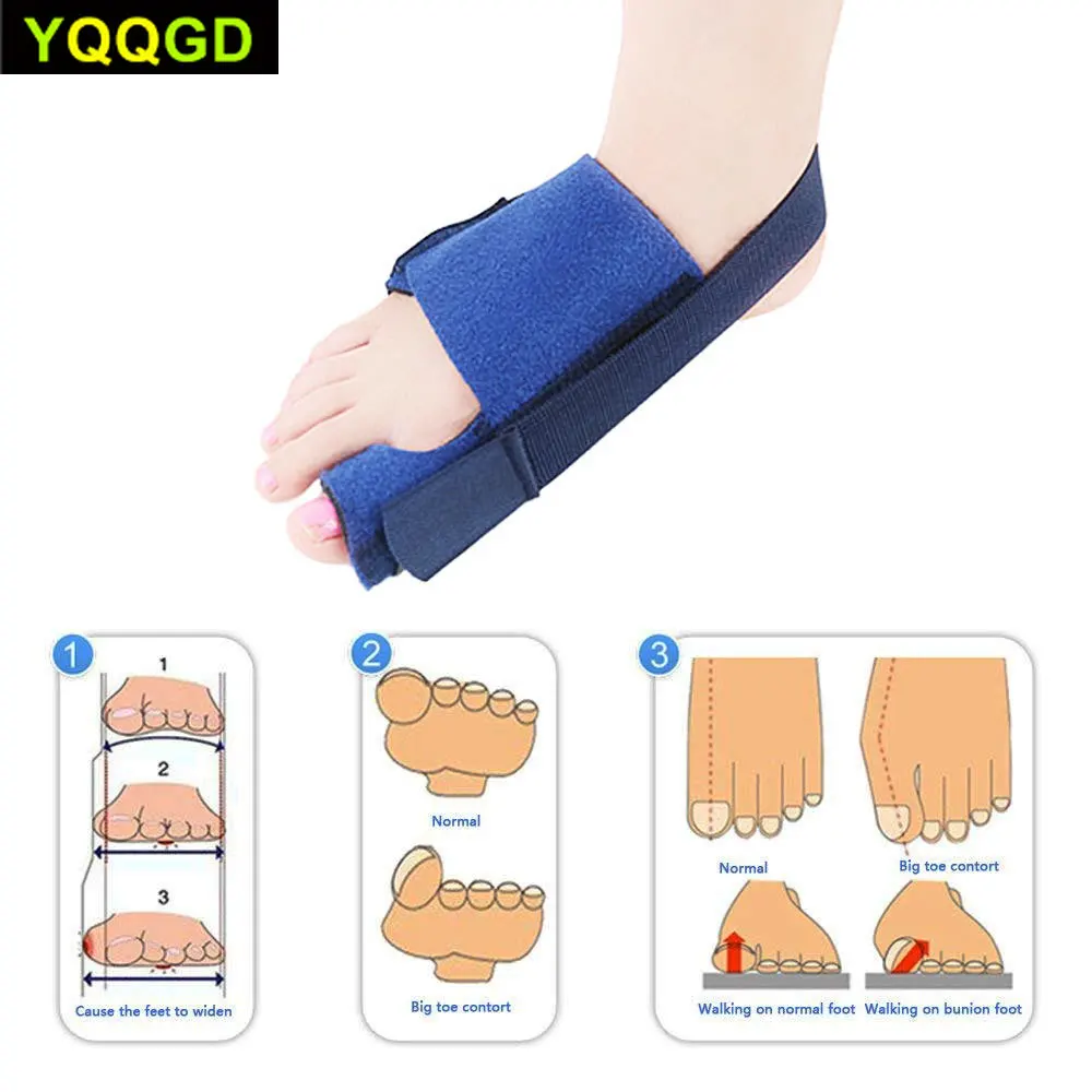 1 шт. Bunion Splint выпрямитель для пальцев ног и корректор Скоба вальгусная деформация