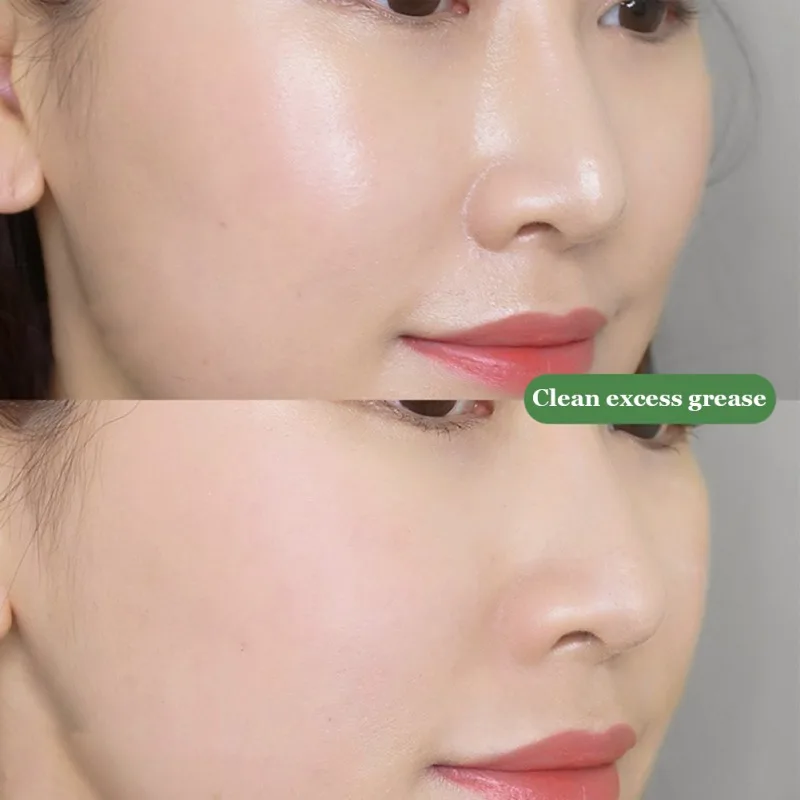 

40g Green Mask Stick Deep Cleansing Oil Control Solid Mask Anti Acne Clearing Blackhead Remover Treatment