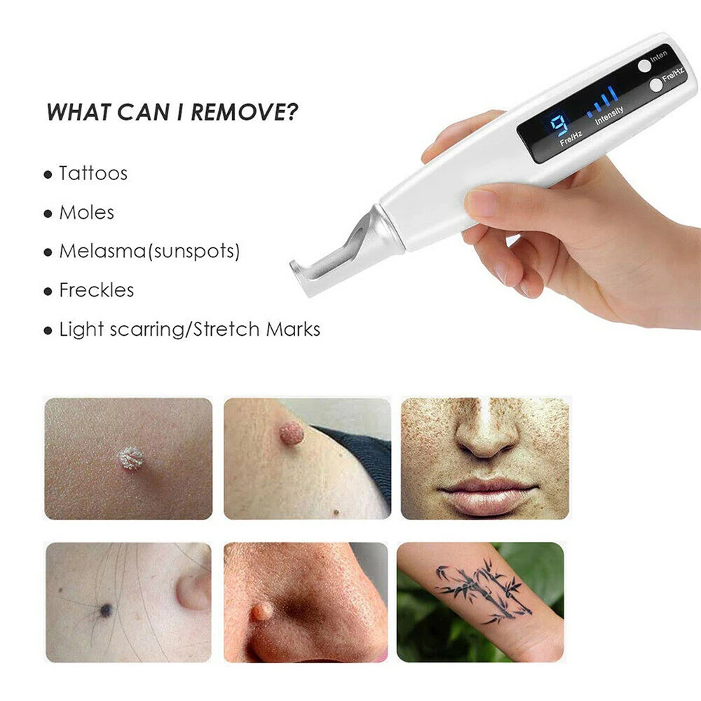 Лазерная ручка пикосекунда DIOZO синяя и красная для удаления татуировок родинок