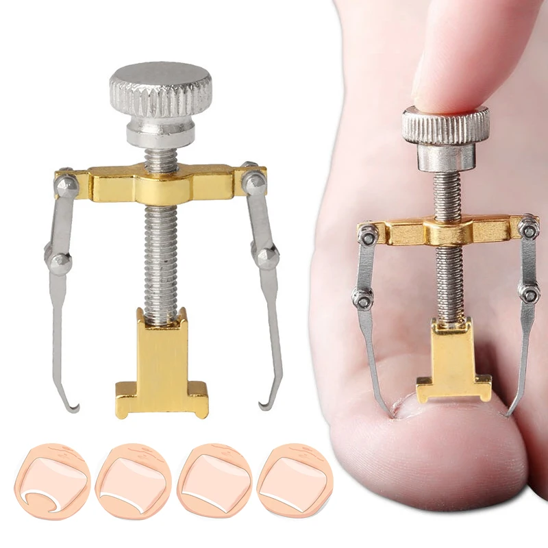 

Ingrown Toenail Corrector Toenail Fixer Bunion Correction Tool Toenails Straightening Clip Brace Toe Nail Care Tool Pedicure