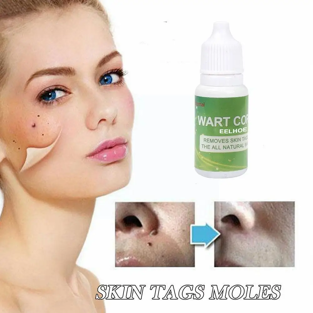 

10ml Skin Tag Remover Skin Tags Genital Wart Remover Care Cream Foot Liquid N8Z1