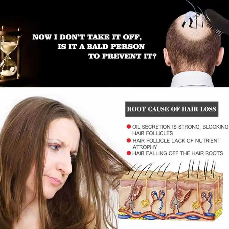 

30ml Hair Oil Hair Growth Essential Oil Anti Hair Loss Nourish Root Hair Care Repairing Liquid Oil Hair Care