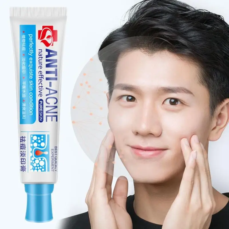 30 мл травяной Традиционный китайский крем для лечения акне сужающийся поры пятна